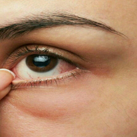خشکی چشم و علت آن