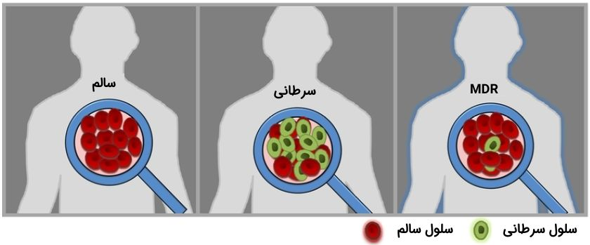 رده بندی های اصلی سرطان بر حسب نوع سلول ها